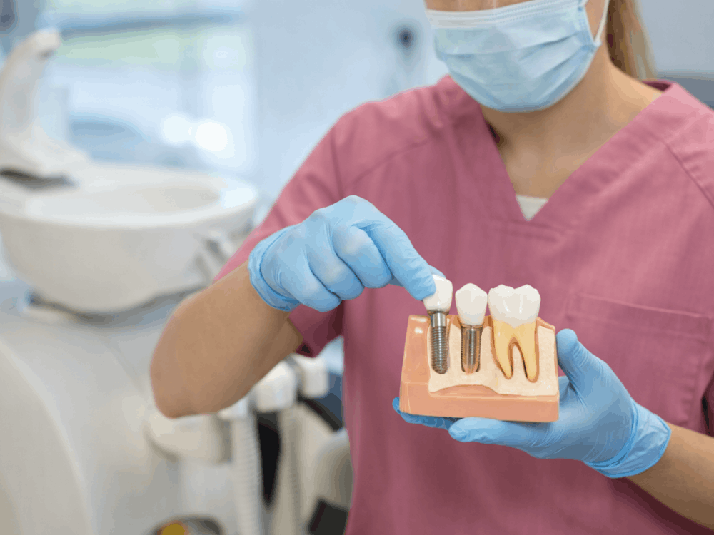 Dental implants treatment in Mexico