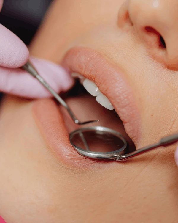 Root canal treatment in playa del carmen