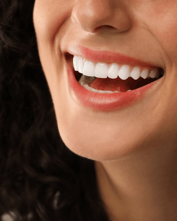 Teeth cleaning in playa del carmen procedure
