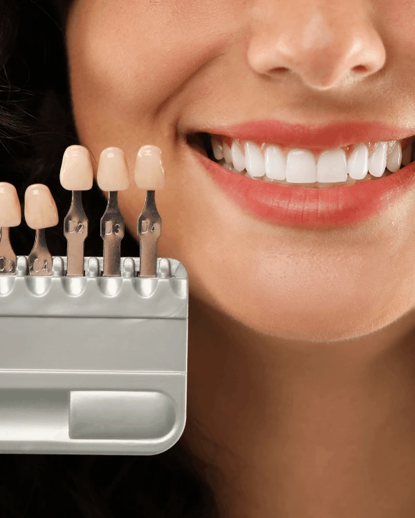 veneers in playa del carmen smile