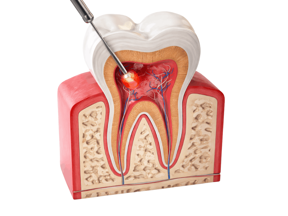 Endodontist specialist working in Playa del Carmen clinic