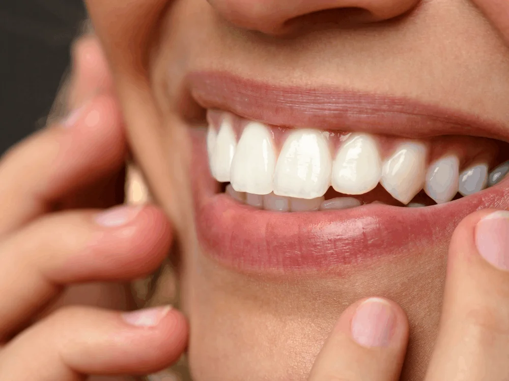 digital smile design preview results playa del carmen cosmetic dentistry