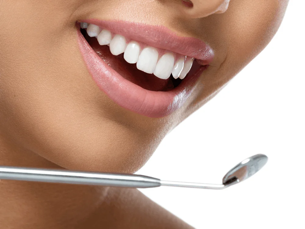 Natural smile design results in Playa del Carmen cosmetic dentistry