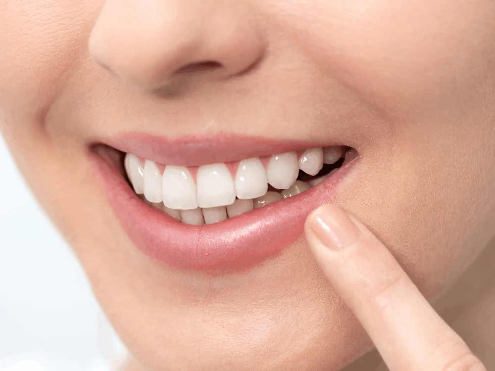 Teeth whitening consultation